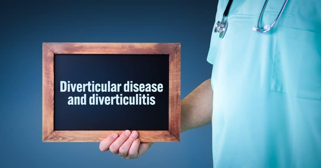 Diverticular disease 2