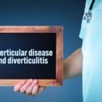 Diverticular disease 2