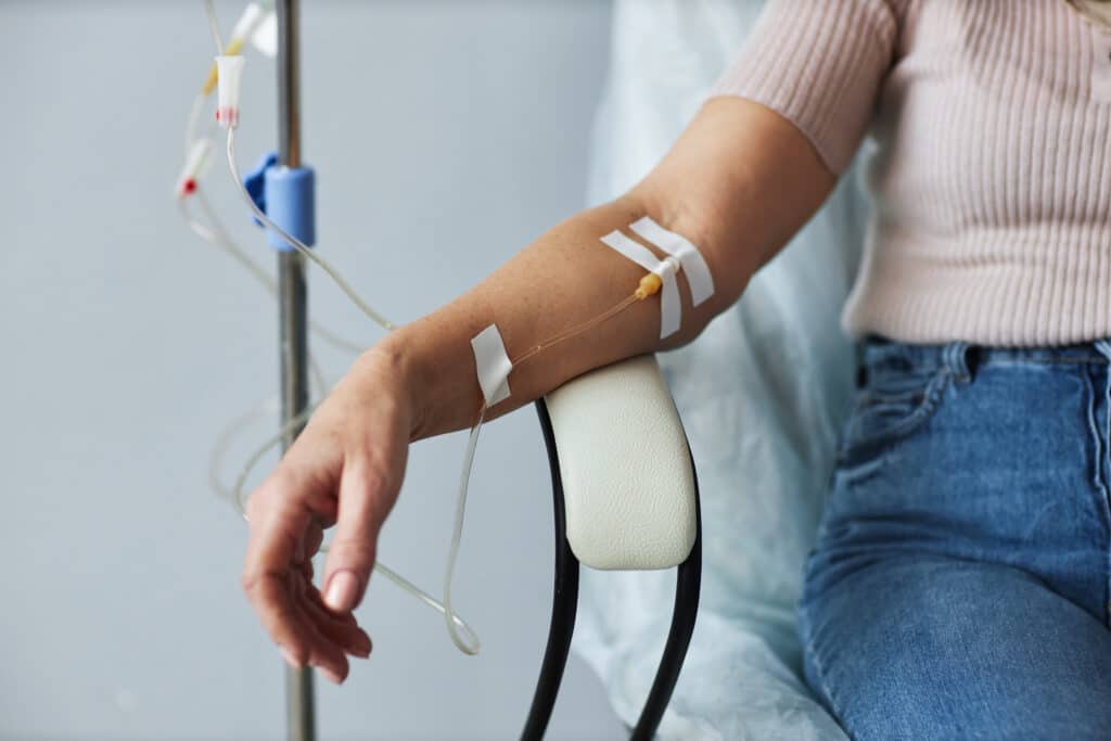 Closeup of female hand with IV drip infusion for Crohn's disease