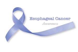 DHC Esophageal Cancer